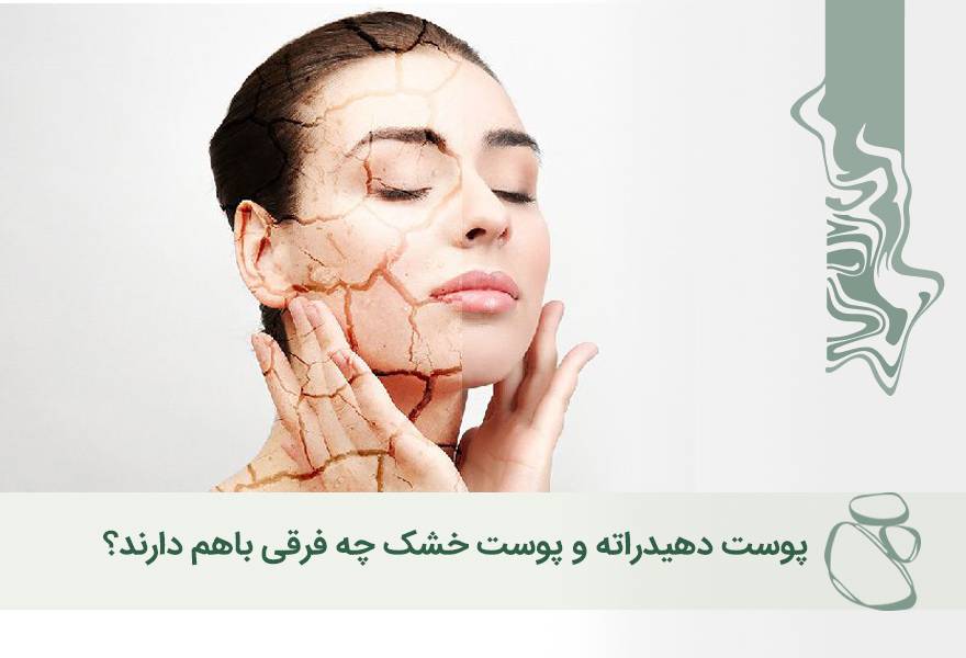 پوست دهیدراته و پوست خشک چه فرقی باهم دارند؟